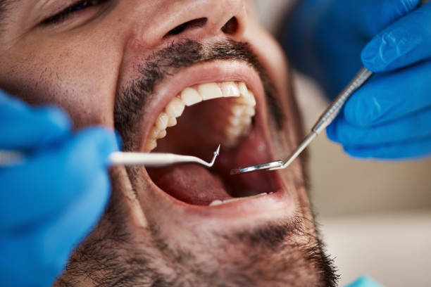 Best Emergency Dental Care for Trauma or Injury in Romulus, MI